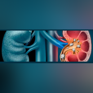 Uro_Mane. Dr Manuel Alcaraznormalized